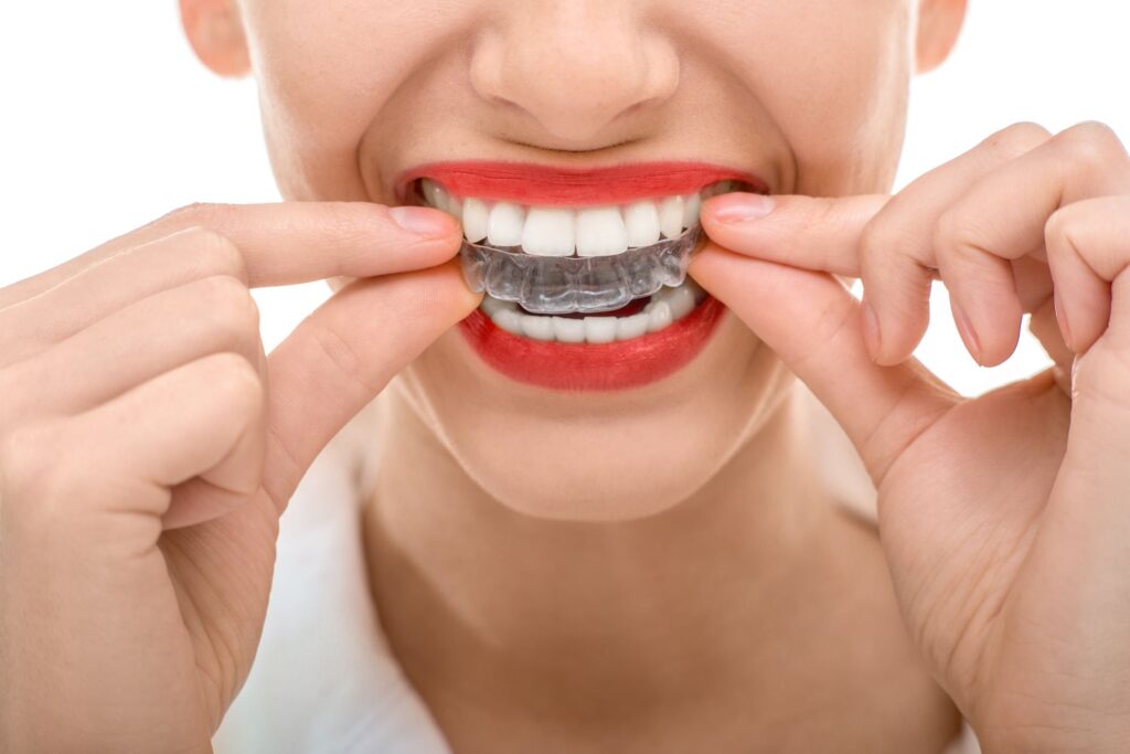 invisalign en Algeciras