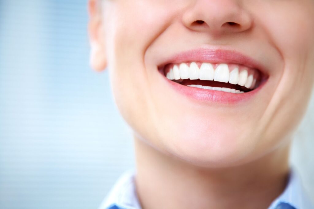 blanqueamiento dental en Algeciras