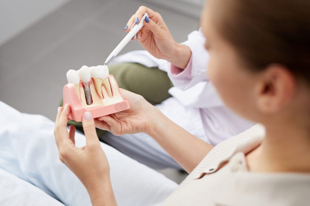 implantes dentales en Algeciras