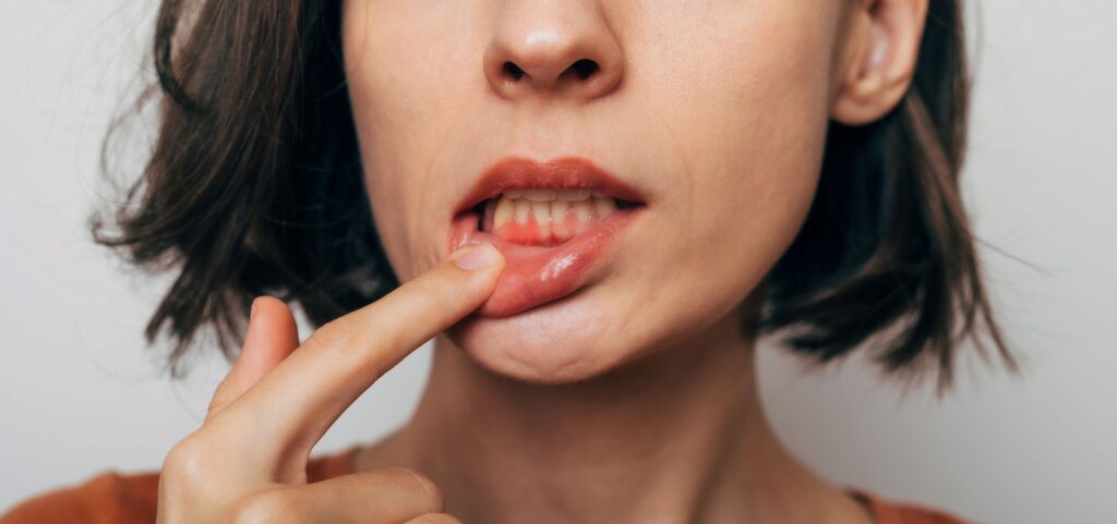 enfermedad periodontal