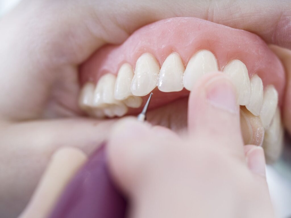 Prótesis vs. implantes dentales