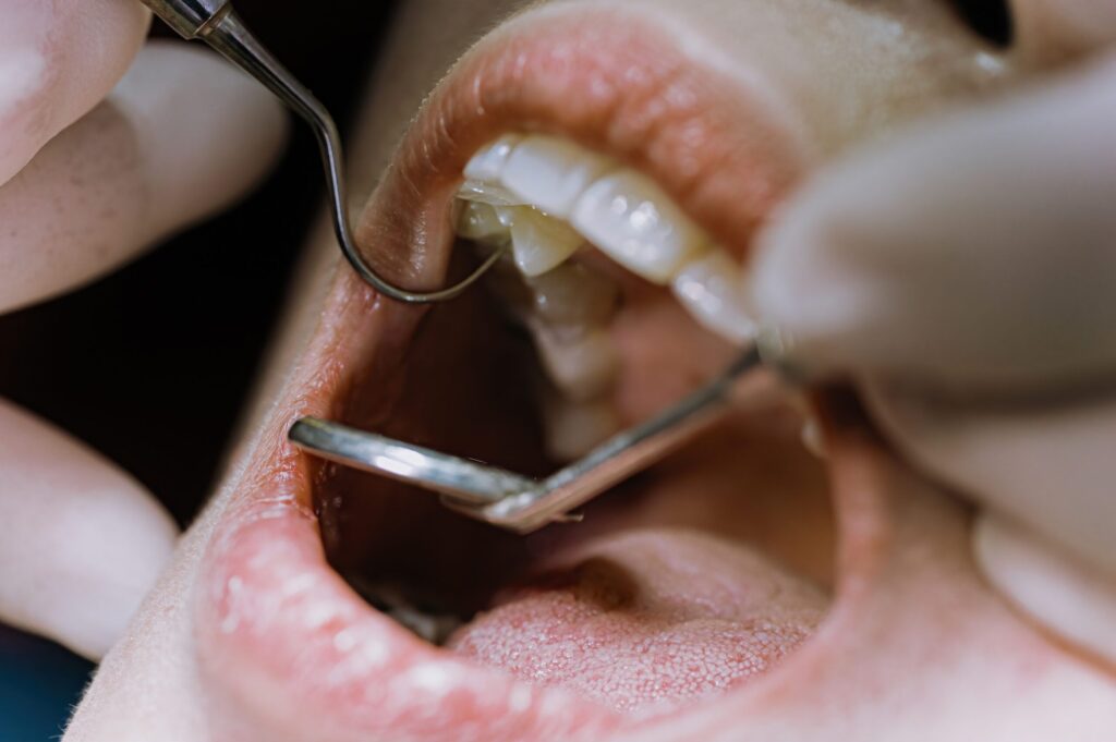 sarro dental