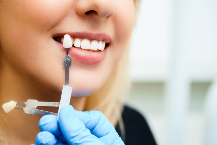 blanqueamiento dental casero